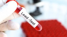 Ngộ độc chì có khả năng đã gây ra hơn 5 triệu ca tử vong mỗi năm