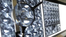 Phim chụp của một bệnh nhân ung thư. Nguồn: TASS.