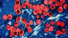 Hình ảnh virus đậu mùa khỉ dưới kính hiển vi. Ảnh: TTXVN.