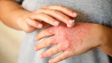 Chăm sóc da vào thời tiết hanh khô: Lời khuyên từ các chuyên gia