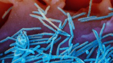 Mỹ: Gia hạn tiêm chủng cho trẻ em do diễn biến dịch RSV phức tạp