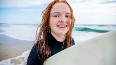 Gen tóc đỏ được tự nhiên “ưu ái” trong suốt 10.000 năm tiến hóa