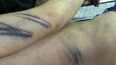 Hình ảnh những vết thương của bị can Minh được gia đình đưa lên mạng xã hội.