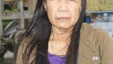 Nguyễn Thị Như trước và sau khi phẫu thuật thẩm mỹ.