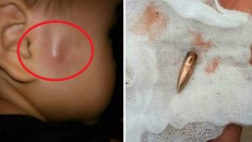 Cháu bé ở thị trấn Gia Khánh, huyện Bình Xuyên, tỉnh Vĩnh Phúc bị đạn lạc rơi trúng.