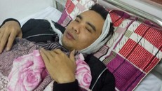 Trưởng ban quản lý tòa hỗn hợp Sông Đà bị đánh vỡ đầu 