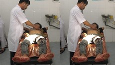 Em C. nhập viện cấp cứu do bạn học đâm