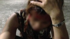 Chị Ph. bị nhân tình của chồng đánh gây thương tích. Ảnh Công Lý.