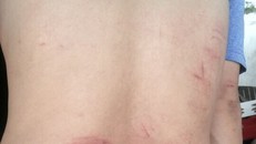  Anh Quý bị nhóm người lạ mặt hành hung.