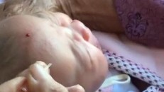 Hình ảnh một em bé làm lễ chích đẹn được chia sẻ trên mạng xã hội. 