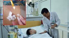 Bác sĩ thăm khám cho bệnh nhân tại Trung tâm Chống độc.