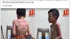 Hình ảnh thông tin lan truyền trên mạng xã hội về bé trai bị cha dượng bạo hành. (Ảnh chụp màn hình)