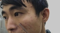 Đối tượng Tùng ra tự thú sau khi sát hại bạn gái