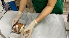 Bé hiện được chăm sóc tại phòng chăm sóc đặc biệt của Đơn vị hồi sức nhi – Bệnh viện quận Thủ Đức