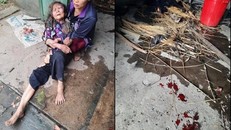 Cụ già hơn 90 tuổi bị kẻ độc ác đánh đập và chất rơm đốt để cướp hơn 20 triệu đồng. 