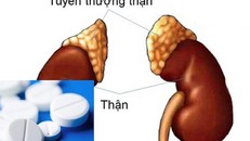 Suy tuyến thượng thận - một tai biến nguy hiểm khi dùng corticoid