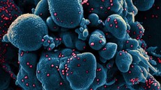 Bức ảnh về một tế bào sắp chết bị nhiễm SARS-CoV-2, với các hạt virus có màu đỏ.