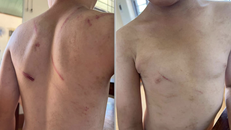 Đắk Lắk tiến hành xác minh, điều tra làm rõ vụ việc cháu bé 9 tuổi bị đánh đập