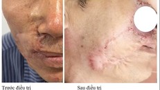 Hình ảnh bệnh nhân trước và sau điều trị.