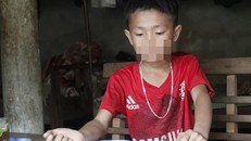 Nam sinh bị thầy giáo đánh. Ảnh: P.H. 