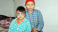 Vụ cô giáo đánh HS bầm tím mặt: Cô giáo chưa đến thăm lần nào