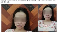 Bức xúc cô gái bị chồng đánh đập khi đang ở cữ ngay trước 8/3