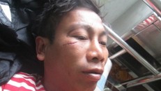 Bí thư hung hãn ra oai đánh người!