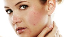 Có biểu hiện này bạn đã mắc ung thư da