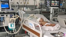 Bệnh nhi K. bị khỉ nhà hàng xóm tấn công, cạp lún sọ