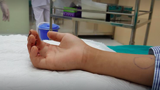 Cháu bé suýt mất ngón tay khi bị kẹt vào thang máy