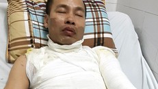 Bé gái hoảng loạn chứng kiến bố đau đớn khi bị tạt axit