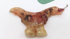 Chiếc răng giả có mấu sắc nhọn được lấy ra - Ảnh: Công an TP.HCM