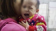 Bệnh nhi bị méo miệng vì tổn thương dây thần kinh số 7 do rét đậm