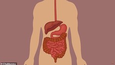 Nôn nóng giảm cân, cô gái uống cả lít nước tương đã bị chết não