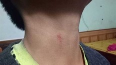 Tố hiệu trưởng bóp cổ học sinh: Chỉ túm cổ áo