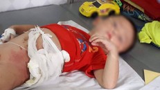 Cậu ruột ném cháu trai 4 tuổi vào đống lửa vì giành ăn quả dưa chuột