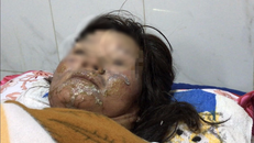 Uống rượu say, chồng hờ tưới xăng đốt vợ