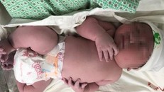 Bé trai mới sinh đã có cân nặng ngang trẻ 3 tháng