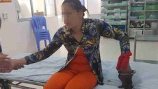 Người phụ nữ bị máy xay thịt ‘nuốt’ gần hết bàn tay