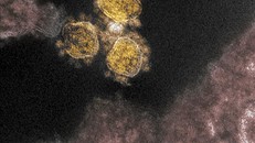 Hình ảnh quét qua kính hiển vi điện tử cho thấy virus SARS-COV-2 trên mẫu bệnh phẩm của bệnh nhân COVID-19 tại Viện Nghiên cứu Dị ứng và Bệnh Truyền nhiễm Quốc gia, Mỹ. Ảnh: AFP/TTXVN