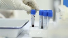 Bộ Y tế yêu cầu chấn chỉnh và xử lý vi phạm việc nhập khẩu, kinh doanh, mua sắm các loại test xét nghiệm nhanh và xét nghiệm RT-PCR. Ảnh minh họa: Minh Quyết/TTXVN