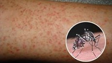 Dịch sốt xuất huyết có chiều hướng lan rộng tại Quảng Ngãi