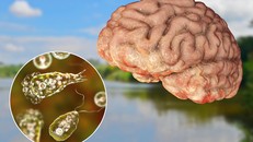 "Amip ăn não" dễ sinh sôi trong môi trường nước ngọt ấm, có thể lây nhiễm vào mũi và xâm nhập lên não người. Ảnh: Newsroom