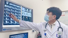 Lóc động mạch chủ, một trong những nguyên nhân chính gây đột tử ở người trẻ