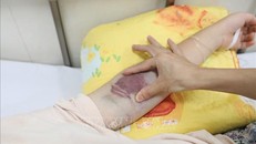 Số ca mắc sốt xuất huyết tăng nhanh tại phố núi Bảo Lộc