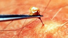 Chuyên gia hướng dẫn cách xử trí khi bị ong đốt