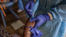 Các tổ chức quốc tế sẽ hỗ trợ hơn 800 triệu USD để châu Phi ứng phó với dịch đậu mùa khỉ