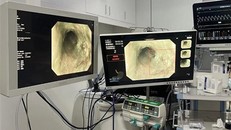 Công nghệ sàng lọc ung thư vú trên "dế" thông minh