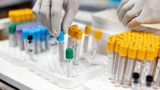 Australia thừa nhận làm mất 300 lọ mẫu virus gây chết người