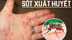 Phát hiện sớm trường hợp mắc sốt xuất huyết, xử lý kịp thời, tránh lây lan